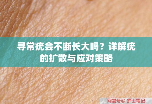 寻常疣会不断长大吗？详解疣的扩散与应对策略