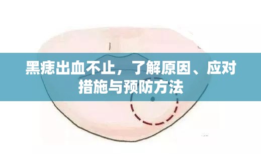 黑痣出血不止，了解原因、应对措施与预防方法