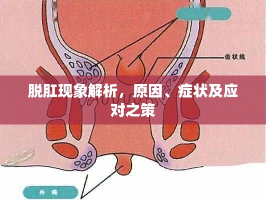 脱肛现象解析，原因、症状及应对之策